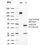 SDS-PAGE - Anti-Prolactin Antibody [PRL/2644] - BSA and Azide free (A252916) - Antibodies.com