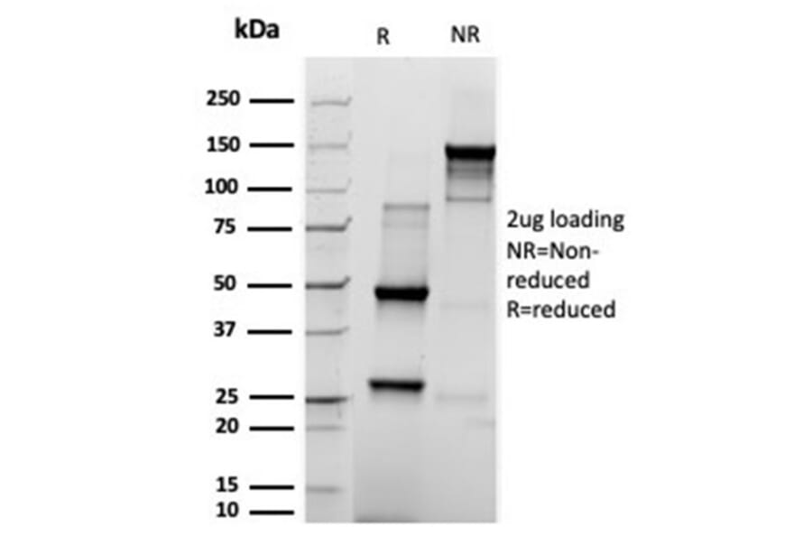 SDS-PAGE - Anti-Prolactin Antibody [rPRL/4909] - BSA and Azide free (A252918) - Antibodies.com