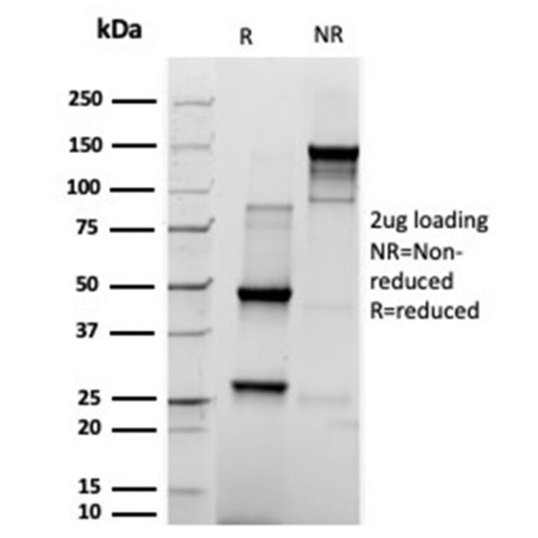 SDS-PAGE - Anti-Prolactin Antibody [rPRL/4909] - BSA and Azide free (A252918) - Antibodies.com