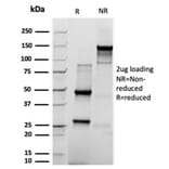 SDS-PAGE - Anti-Prolactin Antibody [rPRL/4909] - BSA and Azide free (A252918) - Antibodies.com
