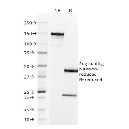 SDS-PAGE - Anti-Prolactin Receptor Antibody [B6.2] - BSA and Azide free (A252919) - Antibodies.com