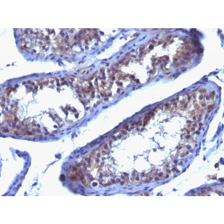 Immunohistochemistry - Anti-Prolactin Receptor Antibody [SPM213] - BSA and Azide free (A252919) - Antibodies.com