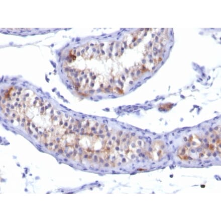 Immunohistochemistry - Anti-Prolactin Receptor Antibody [PRLR/742] - BSA and Azide free (A252920) - Antibodies.com