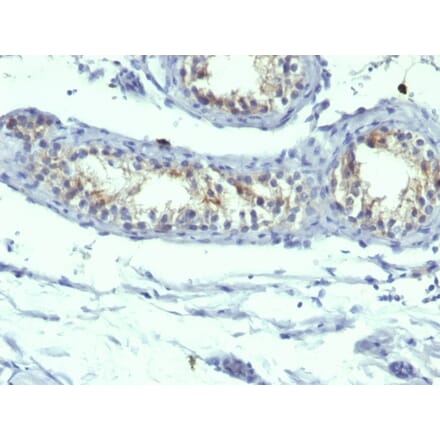 Immunohistochemistry - Anti-Prolactin Receptor Antibody [B6.2 + PRLR742] - BSA and Azide free (A252921) - Antibodies.com