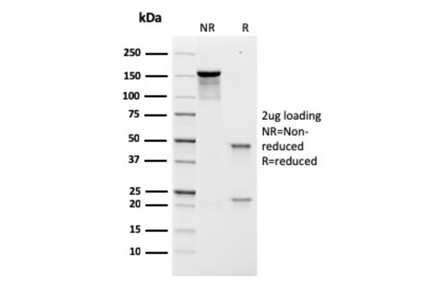 SDS-PAGE - Anti-Prolactin Receptor Antibody [rPRLR/742] - BSA and Azide free (A252923) - Antibodies.com