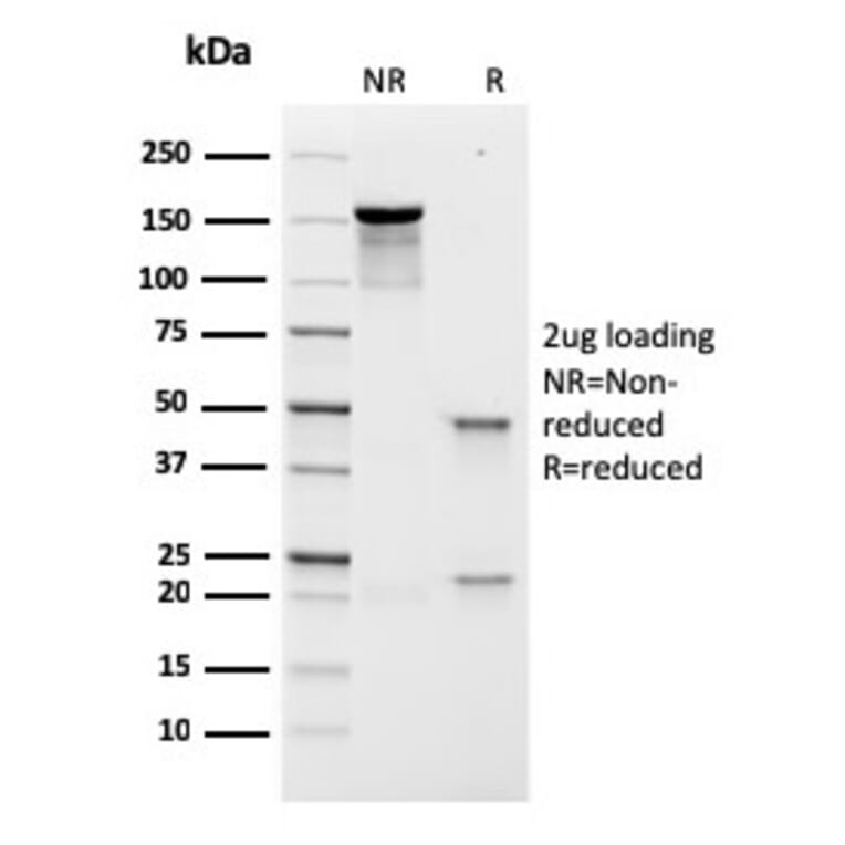 SDS-PAGE - Anti-Prolactin Receptor Antibody [rPRLR/742] - BSA and Azide free (A252923) - Antibodies.com