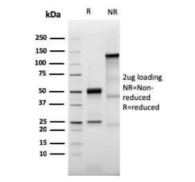 SDS-PAGE - Anti-Prolactin Receptor Antibody [PRLR/3785R] - BSA and Azide free (A252924) - Antibodies.com