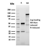 SDS-PAGE - Anti-Prolactin Receptor Antibody [PRLR/3785R] - BSA and Azide free (A252924) - Antibodies.com