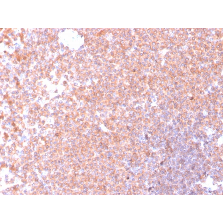 Immunohistochemistry - Anti-Resistin Antibody [RETN/4326] - BSA and Azide free (A252925) - Antibodies.com