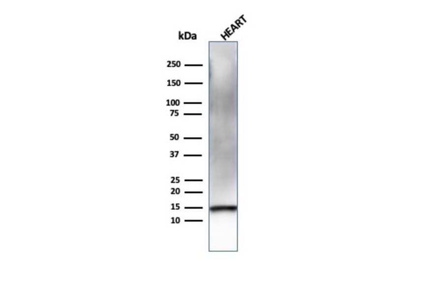 Western Blot - Anti-Resistin Antibody [RETN/4326] - BSA and Azide free (A252925) - Antibodies.com