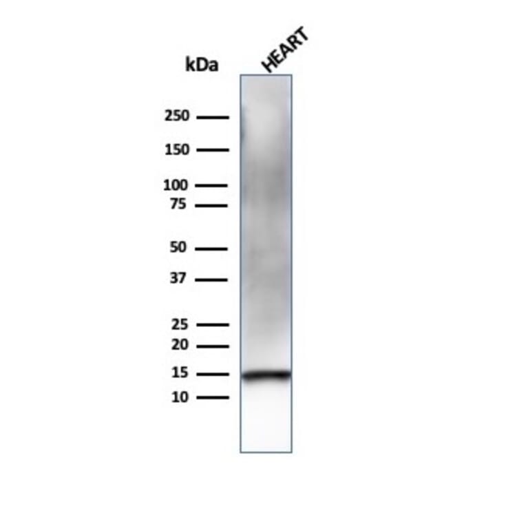 Western Blot - Anti-Resistin Antibody [RETN/4326] - BSA and Azide free (A252925) - Antibodies.com