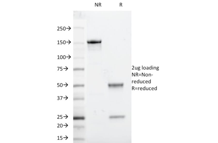 SDS-PAGE - Anti-beta 2 Microglobulin Antibody [246-E9.E7] - BSA and Azide free (A252925) - Antibodies.com
