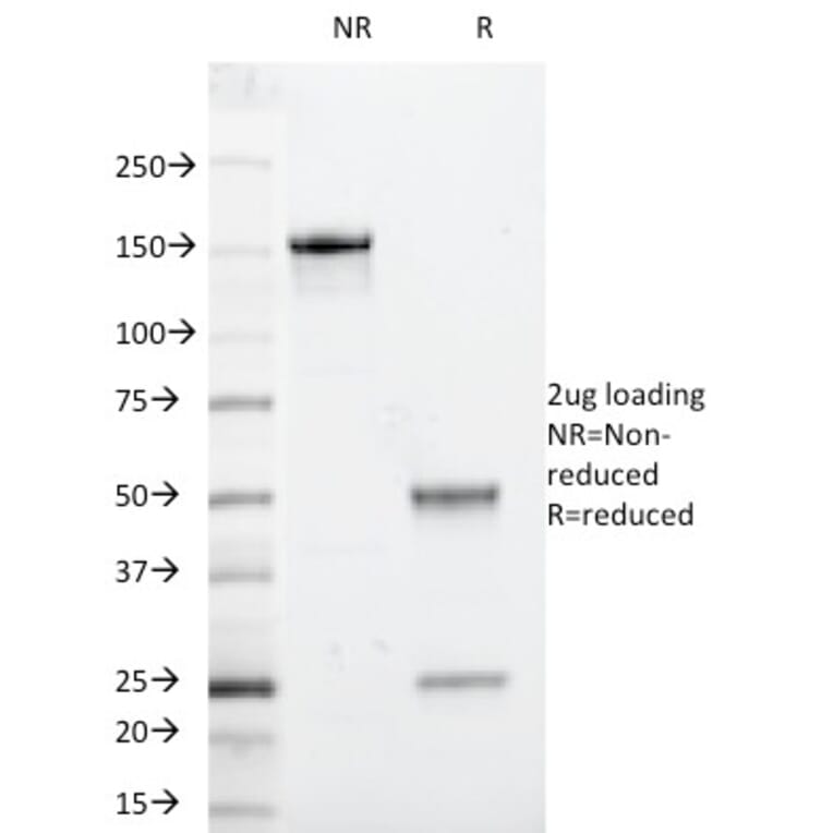 SDS-PAGE - Anti-beta 2 Microglobulin Antibody [246-E9.E7] - BSA and Azide free (A252925) - Antibodies.com