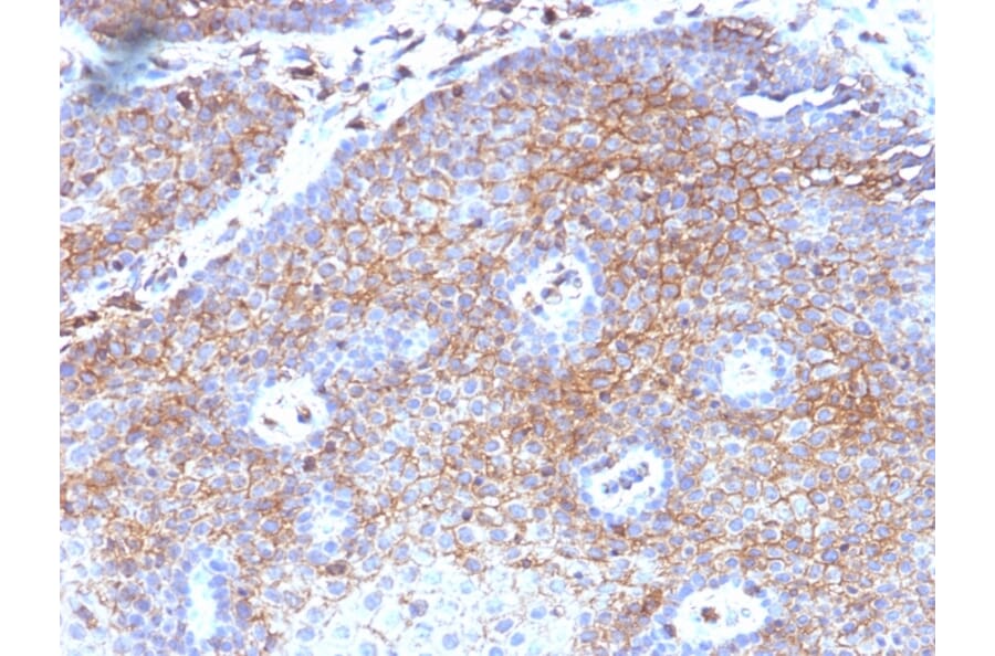 Immunohistochemistry - Anti-beta 2 Microglobulin Antibody [B2M/1118] - BSA and Azide free (A252928) - Antibodies.com