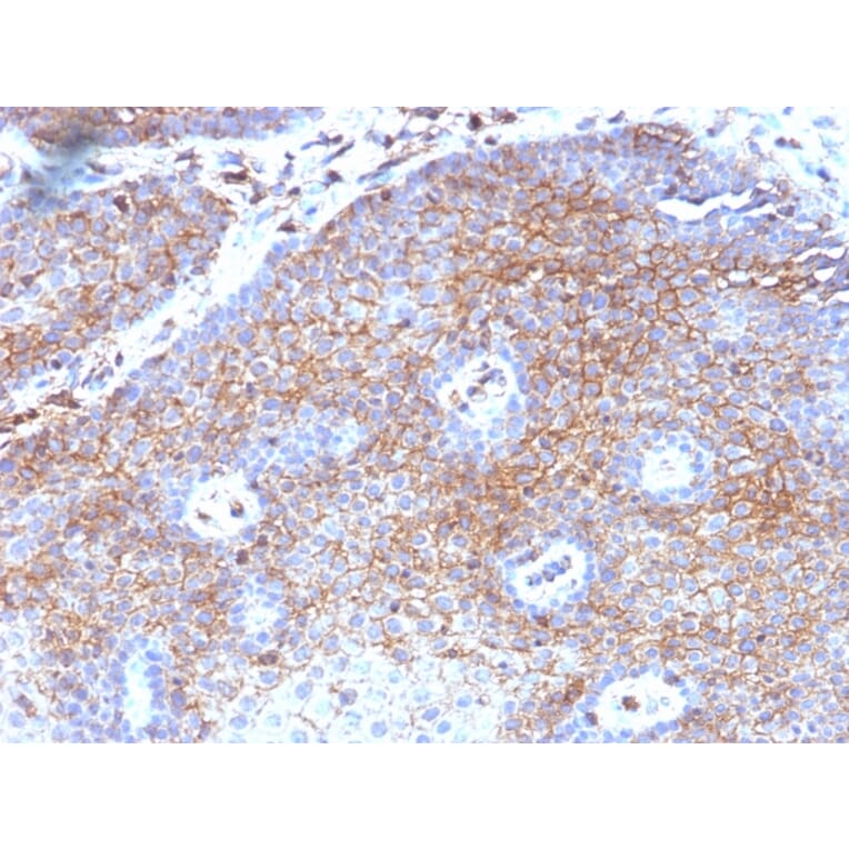 Immunohistochemistry - Anti-beta 2 Microglobulin Antibody [B2M/1118] - BSA and Azide free (A252928) - Antibodies.com