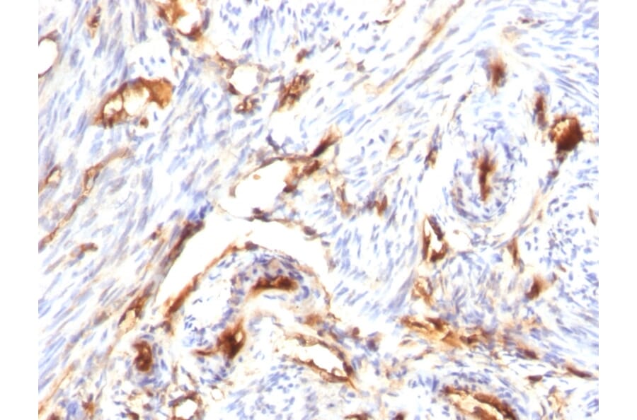 Immunohistochemistry - Anti-beta 2 Microglobulin Antibody [B2M/1118] - BSA and Azide free (A252928) - Antibodies.com