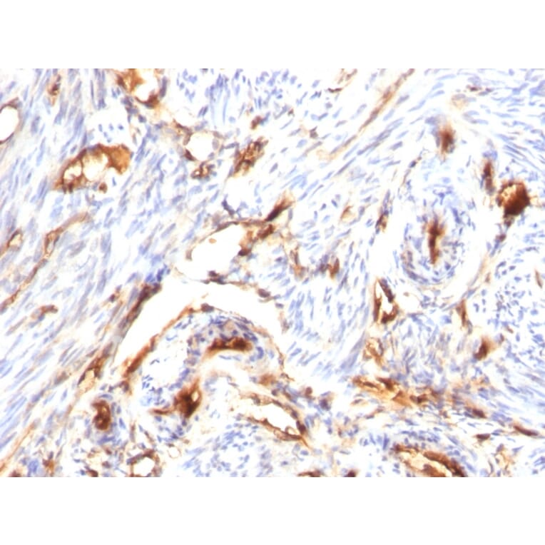 Immunohistochemistry - Anti-beta 2 Microglobulin Antibody [B2M/1118] - BSA and Azide free (A252928) - Antibodies.com