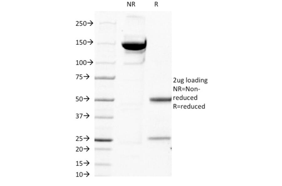 SDS-PAGE - Anti-beta 2 Microglobulin Antibody [B2M/1118] - BSA and Azide free (A252928) - Antibodies.com
