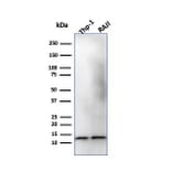 Western Blot - Anti-beta 2 Microglobulin Antibody [B2M/1118] - BSA and Azide free (A252928) - Antibodies.com