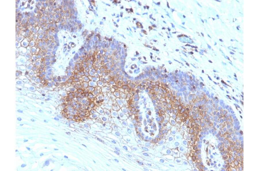 Immunohistochemistry - Anti-beta 2 Microglobulin Antibody [SPM617] - BSA and Azide free (A252929) - Antibodies.com