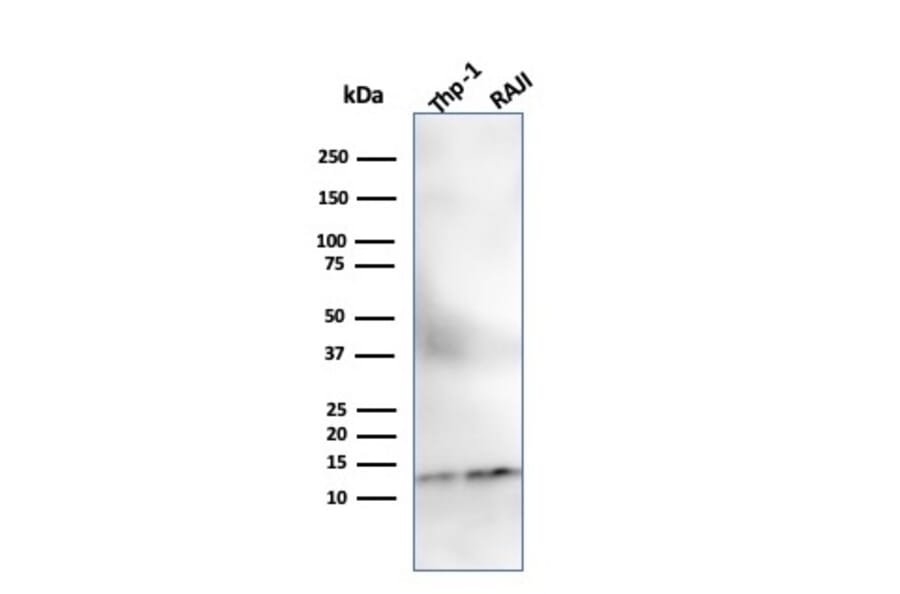 Western Blot - Anti-beta 2 Microglobulin Antibody [SPM617] - BSA and Azide free (A252929) - Antibodies.com