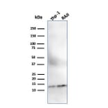 Western Blot - Anti-beta 2 Microglobulin Antibody [SPM617] - BSA and Azide free (A252929) - Antibodies.com