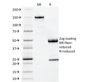 SDS-PAGE - Anti-beta 2 Microglobulin Antibody [BBM.1] - BSA and Azide free (A252930) - Antibodies.com