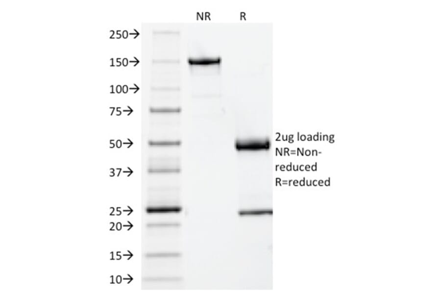 SDS-PAGE - Anti-beta 2 Microglobulin Antibody [BBM.1] - BSA and Azide free (A252930) - Antibodies.com