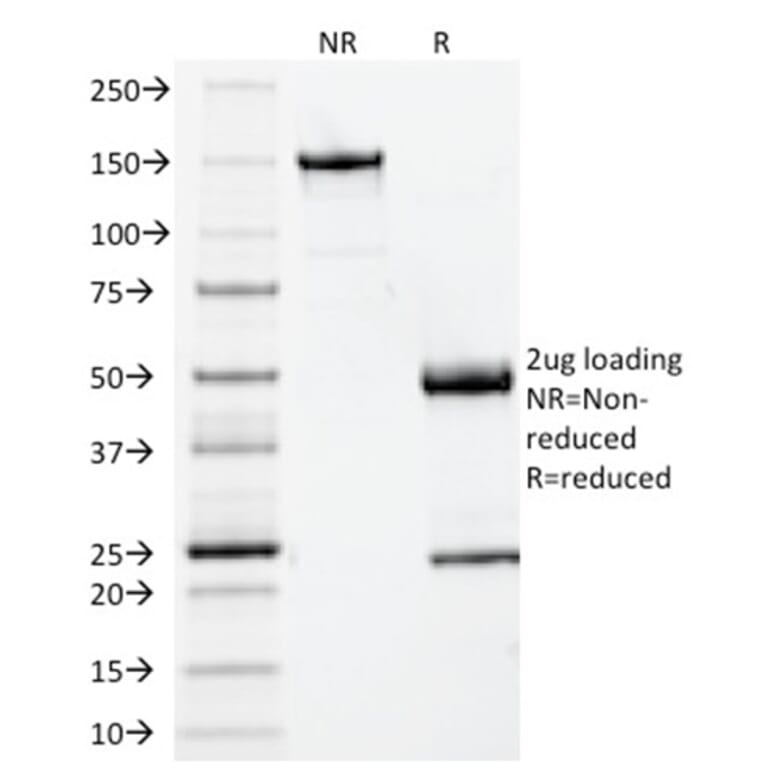 SDS-PAGE - Anti-beta 2 Microglobulin Antibody [BBM.1] - BSA and Azide free (A252930) - Antibodies.com