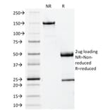 SDS-PAGE - Anti-beta 2 Microglobulin Antibody [BBM.1] - BSA and Azide free (A252930) - Antibodies.com