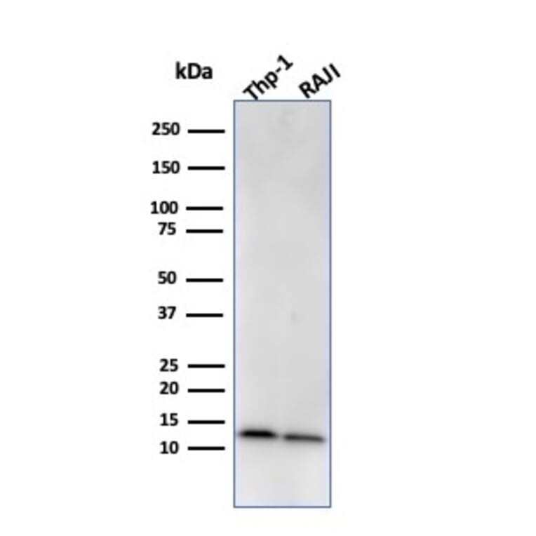 Western Blot - Anti-beta 2 Microglobulin Antibody [BBM.1] - BSA and Azide free (A252930) - Antibodies.com