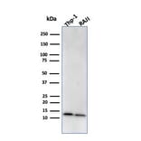 Western Blot - Anti-beta 2 Microglobulin Antibody [BBM.1] - BSA and Azide free (A252930) - Antibodies.com