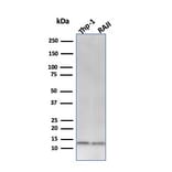 Western Blot - Anti-beta 2 Microglobulin Antibody [C21.48A1] - BSA and Azide free (A252931) - Antibodies.com