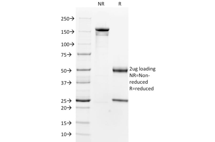 SDS-PAGE - Anti-beta 2 Microglobulin Antibody [B2M/961] - BSA and Azide free (A252932) - Antibodies.com