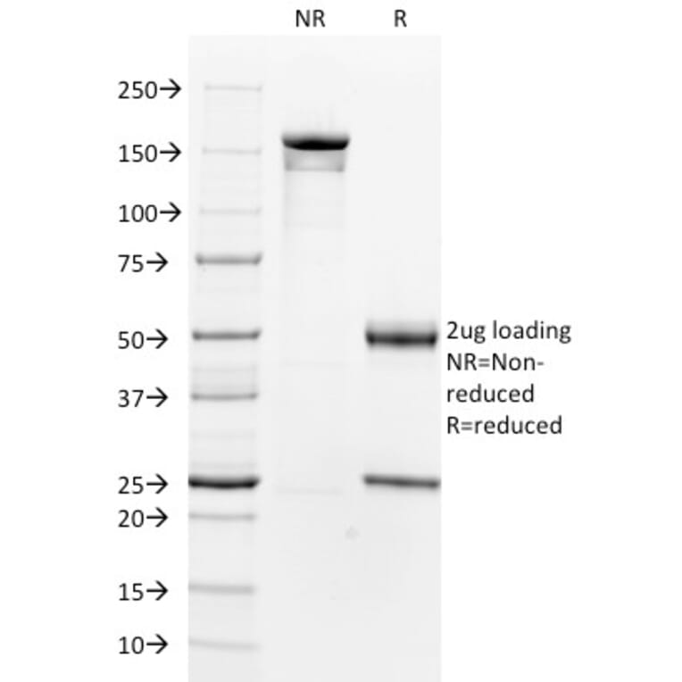 SDS-PAGE - Anti-beta 2 Microglobulin Antibody [B2M/961] - BSA and Azide free (A252932) - Antibodies.com