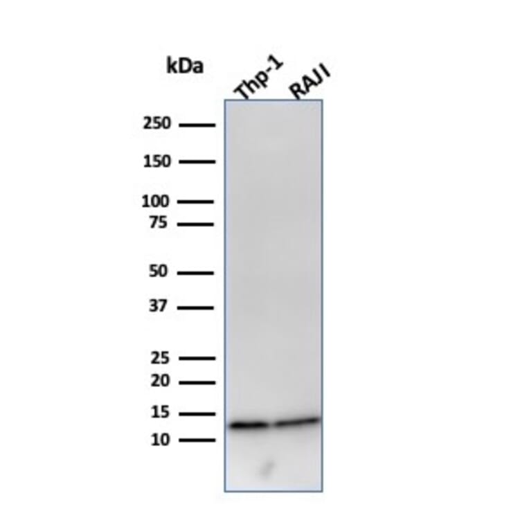 Western Blot - Anti-beta 2 Microglobulin Antibody [B2M/961] - BSA and Azide free (A252932) - Antibodies.com