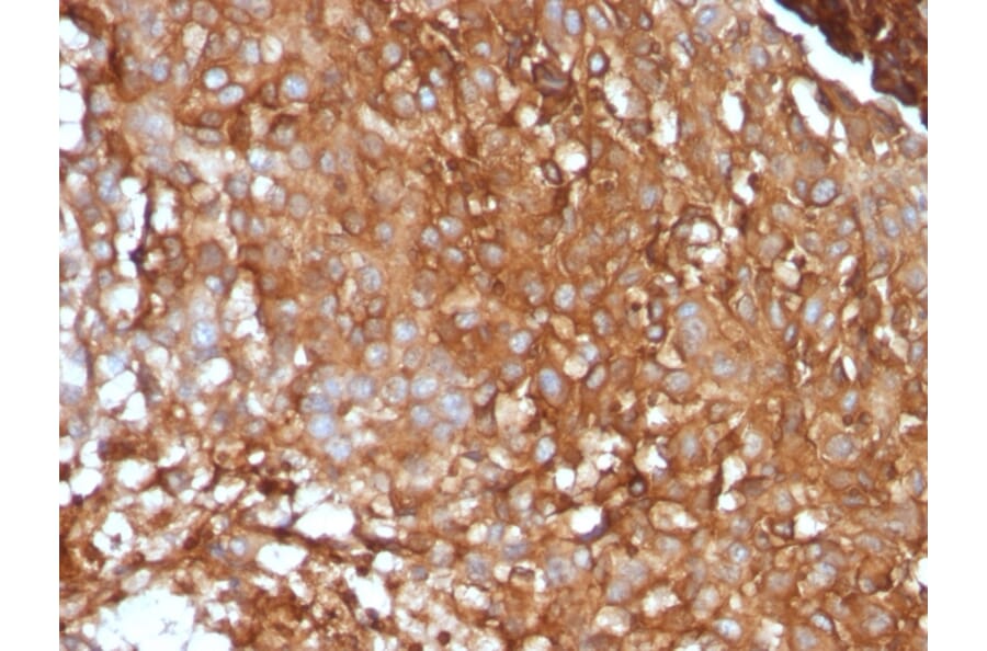 Immunohistochemistry - Anti-beta 2 Microglobulin Antibody [B2M/961] - BSA and Azide free (A252932) - Antibodies.com