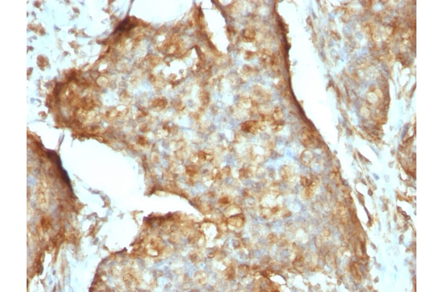 Immunohistochemistry - Anti-beta 2 Microglobulin Antibody [B2M/961] - BSA and Azide free (A252932) - Antibodies.com