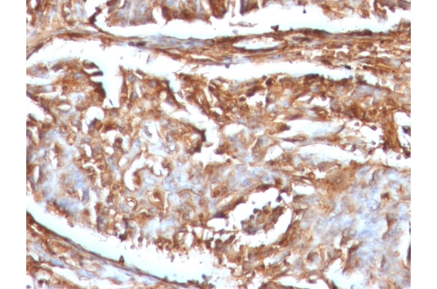 Immunohistochemistry - Anti-beta 2 Microglobulin Antibody [B2M/961] - BSA and Azide free (A252932) - Antibodies.com
