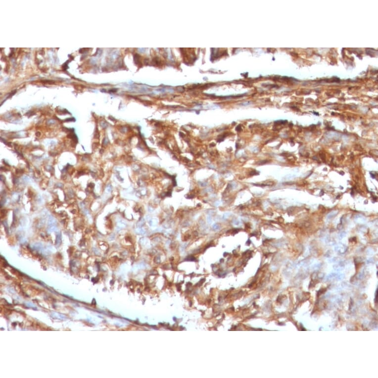 Immunohistochemistry - Anti-beta 2 Microglobulin Antibody [B2M/961] - BSA and Azide free (A252932) - Antibodies.com