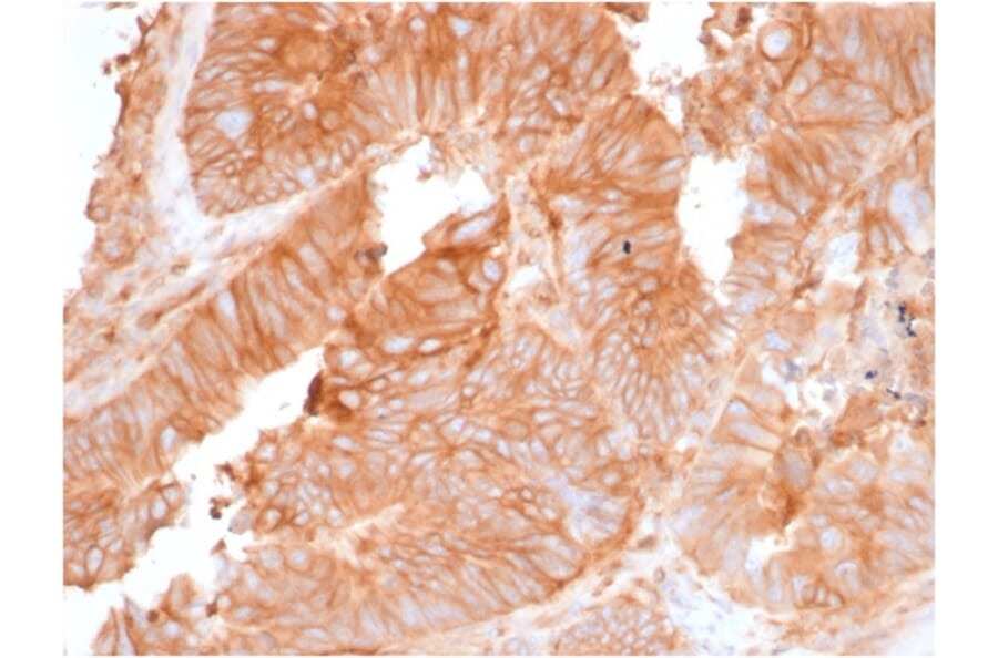 Immunohistochemistry - Anti-beta 2 Microglobulin Antibody [rB2M/961] - BSA and Azide free (A252933) - Antibodies.com