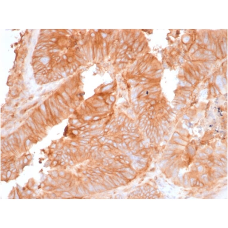 Immunohistochemistry - Anti-beta 2 Microglobulin Antibody [rB2M/961] - BSA and Azide free (A252933) - Antibodies.com