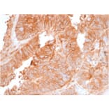 Immunohistochemistry - Anti-beta 2 Microglobulin Antibody [rB2M/961] - BSA and Azide free (A252933) - Antibodies.com