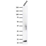 Western Blot - Anti-beta 2 Microglobulin Antibody [rB2M/961] - BSA and Azide free (A252933) - Antibodies.com