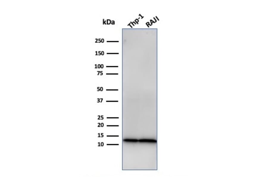 Western Blot - Anti-beta 2 Microglobulin Antibody [rB2M/961] - BSA and Azide free (A252933) - Antibodies.com