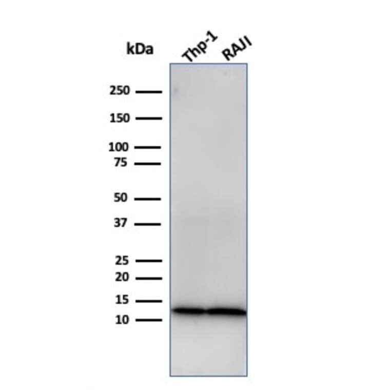 Western Blot - Anti-beta 2 Microglobulin Antibody [rB2M/961] - BSA and Azide free (A252933) - Antibodies.com