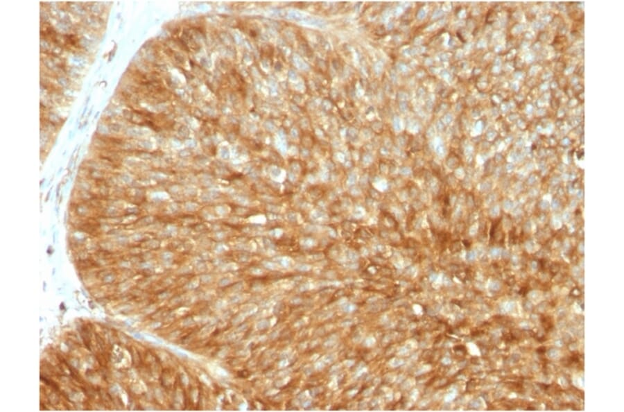 Immunohistochemistry - Anti-beta 2 Microglobulin Antibody [B2M/1857R] - BSA and Azide free (A252934) - Antibodies.com