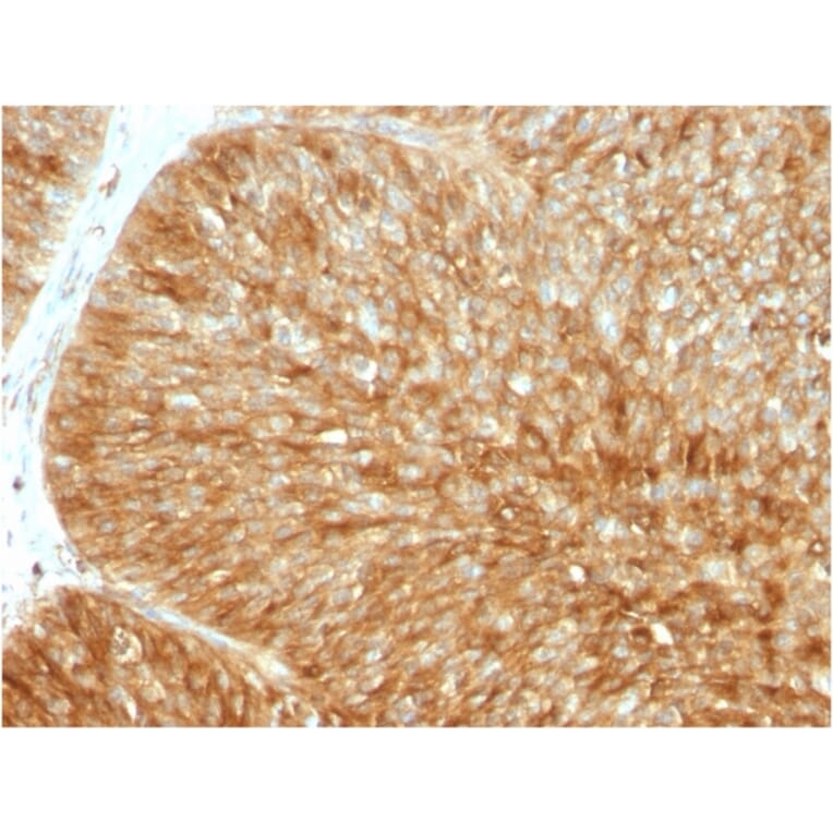 Immunohistochemistry - Anti-beta 2 Microglobulin Antibody [B2M/1857R] - BSA and Azide free (A252934) - Antibodies.com