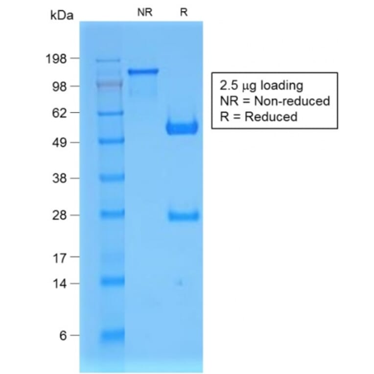 SDS-PAGE - Anti-beta 2 Microglobulin Antibody [B2M/1857R] - BSA and Azide free (A252934) - Antibodies.com