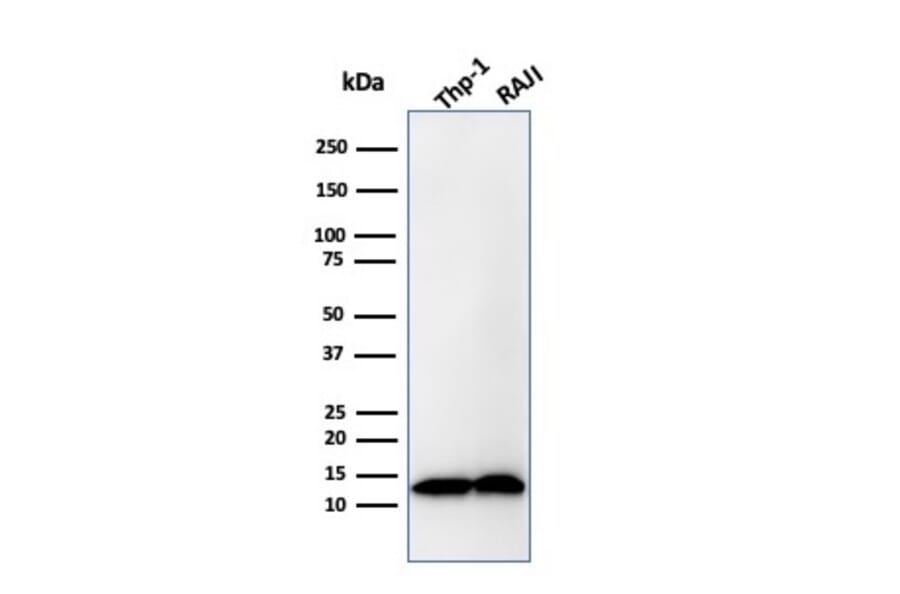 Western Blot - Anti-beta 2 Microglobulin Antibody [B2M/1857R] - BSA and Azide free (A252934) - Antibodies.com